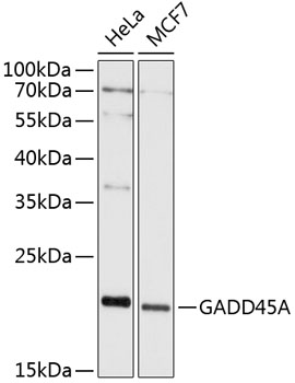 GADD45A Polyclonal Antibody (100 µl)