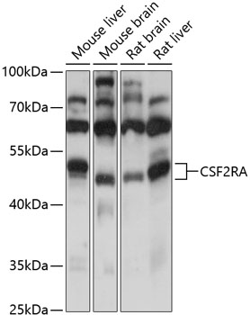CSF2RA Polyclonal Antibody (50 µl)