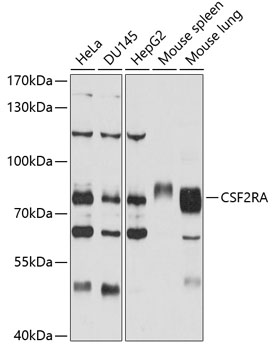 CSF2RA Polyclonal Antibody (50 µl)