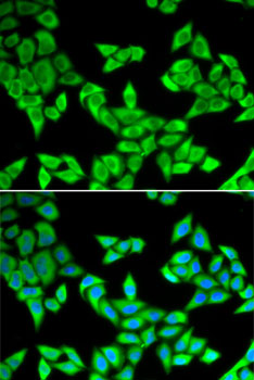 CIAPIN1 Polyclonal Antibody (50 µl)