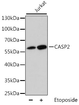 CASP2 Polyclonal Antibody (50 µl)