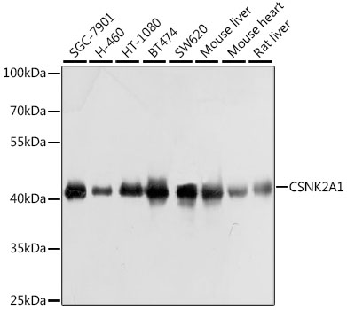 CSNK2A1 Polyclonal Antibody (50 µl)
