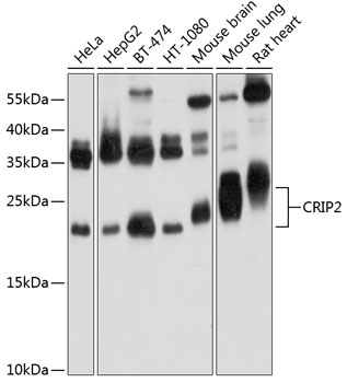 CRIP2 Polyclonal Antibody (100 µl)