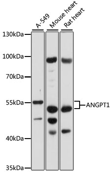 ANGPT1 Polyclonal Antibody (100 µl)