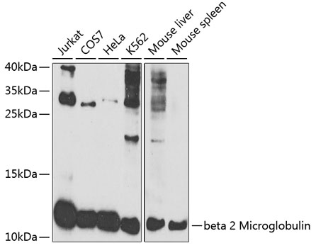 beta 2 Microglobulin Polyclonal Antibody (100 µl)