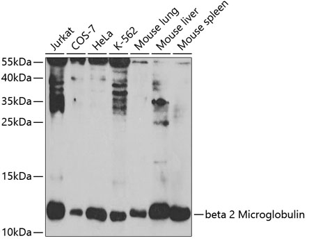 beta 2 Microglobulin Polyclonal Antibody (50 µl)