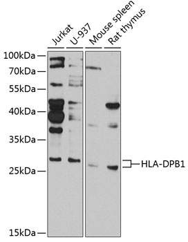 HLA-DPB1 Polyclonal Antibody (100 µl)