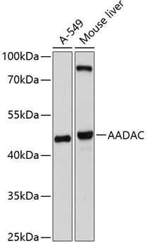 AADAC Polyclonal Antibody (50 µl)