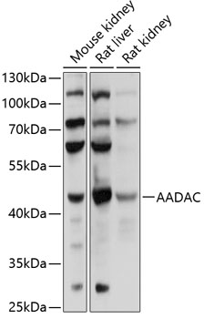 AADAC Polyclonal Antibody (100 µl)