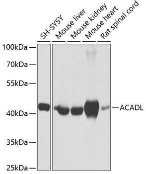 ACADL Polyclonal Antibody (100 µl)