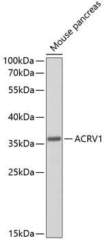 ACRV1 Polyclonal Antibody (100 µl)