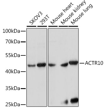 ACTR10 Polyclonal Antibody (100 µl)