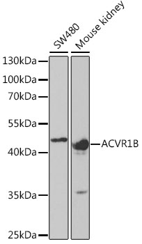 ACVR1B Polyclonal Antibody (100 µl)
