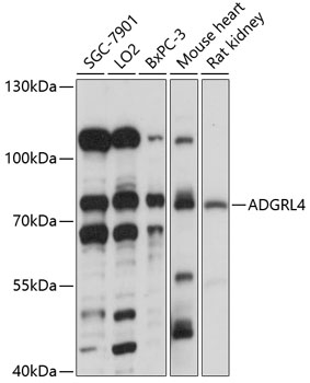 ADGRL4 Polyclonal Antibody (50 µl)