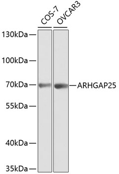 ARHGAP25 Polyclonal Antibody (100 µl)