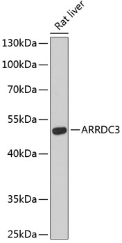 ARRDC3 Polyclonal Antibody (50 µl)
