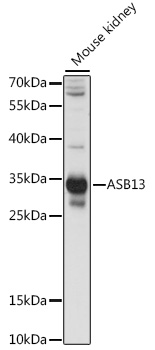 ASB13 Polyclonal Antibody (100 µl)