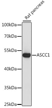 ASCC1 Polyclonal Antibody (100 µl)
