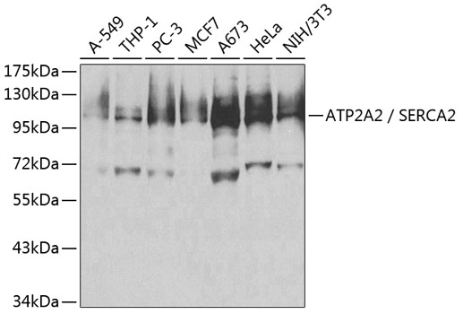 ATP2A2-SERCA2 Polyclonal Antibody (100 µl)