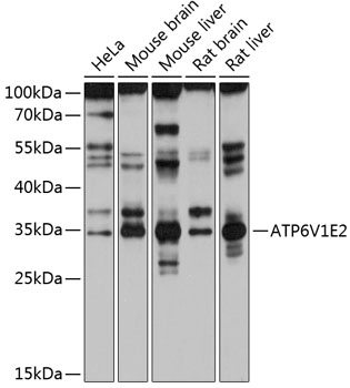 ATP6V1E2 Polyclonal Antibody (50 µl)