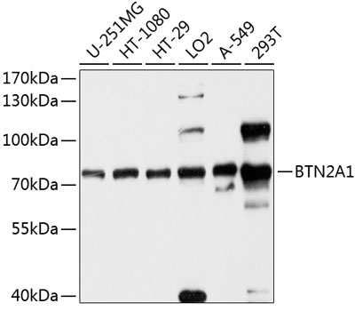 BTN2A1 Polyclonal Antibody (100 µl)