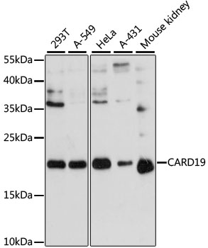 CARD19 Polyclonal Antibody (50 µl)
