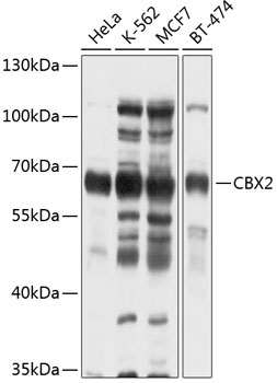 CBX2 Polyclonal Antibody (100 µl)