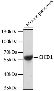 CHID1 Polyclonal Antibody (100 µl)