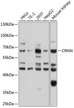 CRNN Polyclonal Antibody (50 µl)