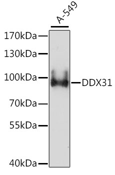 DDX31 Polyclonal Antibody (50 µl)