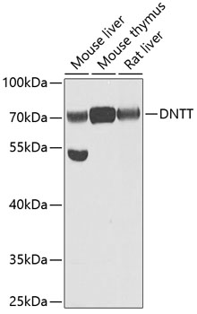 DNTT Polyclonal Antibody (100 µl)