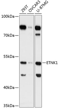 ETNK1 Polyclonal Antibody (50 µl)
