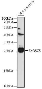 EXOSC5 Polyclonal Antibody (50 µl)