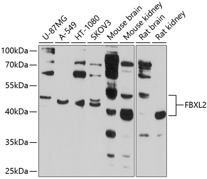 FBXL2 Polyclonal Antibody (100 µl)