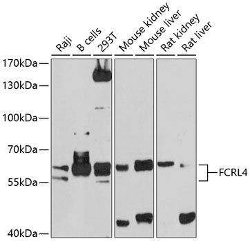 FCRL4 Polyclonal Antibody (50 µl)