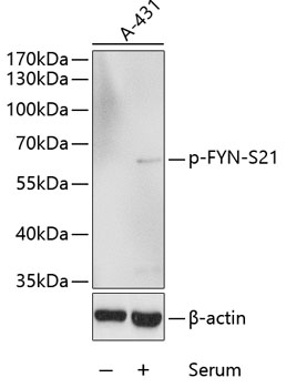Phospho-FYN-S21 Polyclonal Antibody
