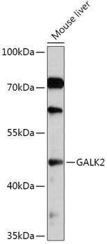 GALK2 Polyclonal Antibody (100 µl)