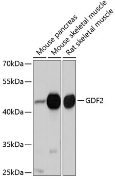 GDF2 Polyclonal Antibody (50 µl)