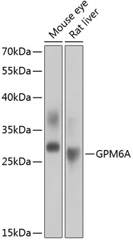 GPM6A Polyclonal Antibody (100 µl)