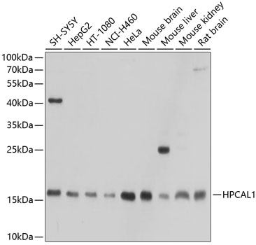 HPCAL1 Polyclonal Antibody (100 µl)