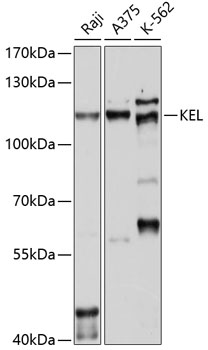 KEL Polyclonal Antibody (100 µl)