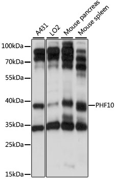 PHF10 Polyclonal Antibody (50 µl)