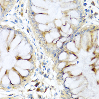 PI3 Polyclonal Antibody