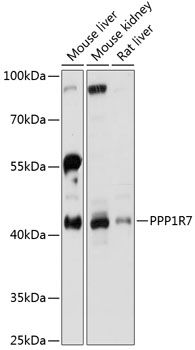 PPP1R7 Polyclonal Antibody (100 µl)