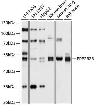 PPP2R2B Polyclonal Antibody (100 µl)