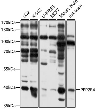 PPP2R4 Polyclonal Antibody (100 µl)