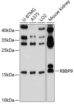 RBBP9 Polyclonal Antibody (100 µl)