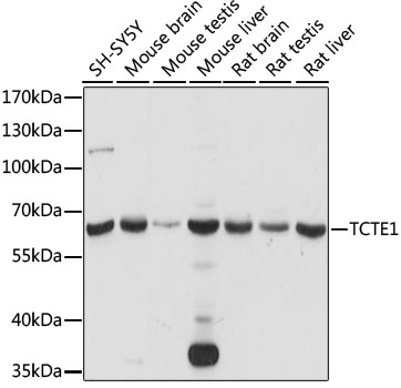 TCTE1 Polyclonal Antibody