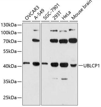UBLCP1 Polyclonal Antibody (100 µl)