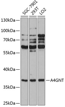 A4GNT Polyclonal Antibody (100 µl)